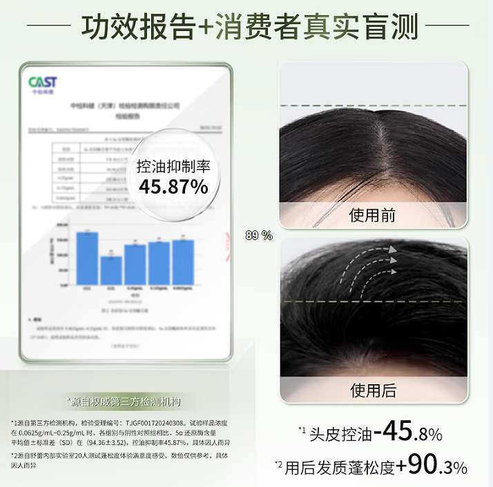 舒蕾控油去屑烁金洗发露-400g